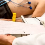 Electrocardiogram Tests