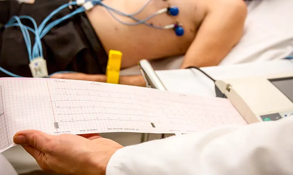 Electrocardiogram Tests